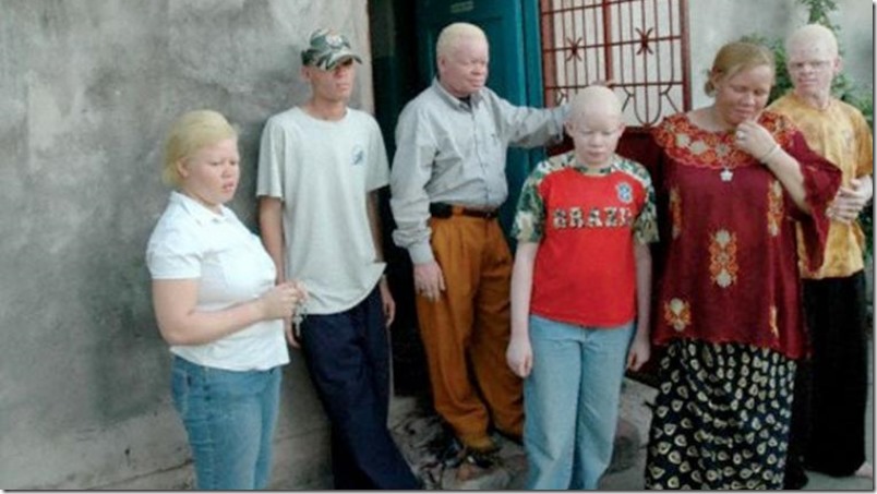 albinos-guna-panama-foto-EFE
